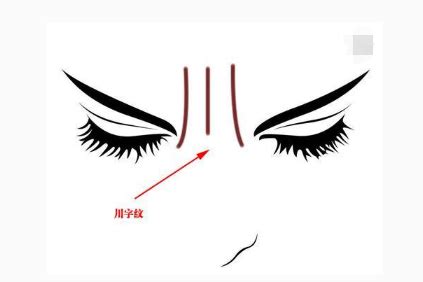 眉頭川字紋,女人眉間有川字好不好